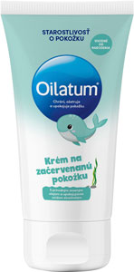 Oilatum krém na začervenanú pokožku 100 ml